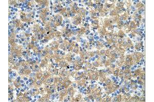 Image no. 1 for anti-MARVEL Domain Containing 3 (MARVELD3) (AA 219-268) antibody (ABIN6739457) (MARVELD3 antibody  (AA 219-268))