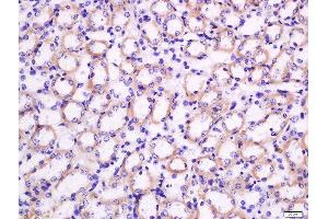 Formalin-fixed and paraffin embedded mouse kidney tissue labeled with Rabbit Anti-Nocturnin Polyclonal Antibody, Unconjugated  at 1:200 followed by conjugation to the secondary antibody and DAB staining (CCRN4L antibody  (AA 231-330))