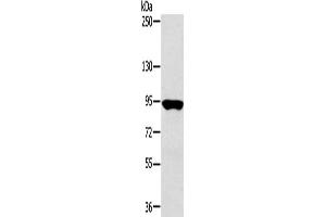 Gel: 6 % SDS-PAGE, Lysate: 40 μg, Lane: Hepg2 cells, Primary antibody: ABIN7130902(RNF214 Antibody) at dilution 1/250, Secondary antibody: Goat anti rabbit IgG at 1/8000 dilution, Exposure time: 20 seconds (RNF214 antibody)