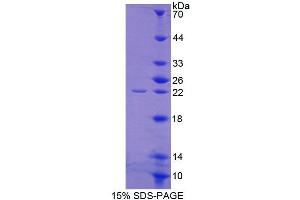 SDS-PAGE (SDS) image for Adrenocortical Dysplasia Homolog (ACD) (AA 147-342) protein (His tag) (ABIN4989116)