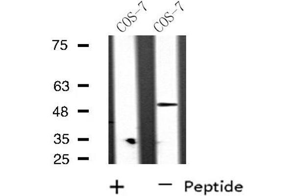 RAD51C antibody  (Internal Region)