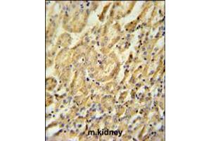 BTBD9 Antibody immunohistochemistry analysis in formalin fixed and paraffin embedded mouse kidney tissue followed by peroxidase conjugation of the secondary antibody and DAB staining.