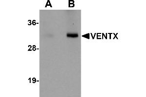 Western Blotting (WB) image for anti-VENT Homeobox (VENTX) (Middle Region) antibody (ABIN1031159) (VENTX antibody  (Middle Region))