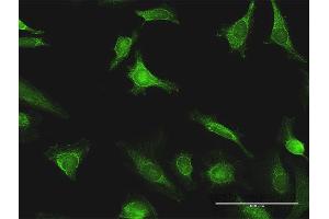 Immunofluorescence of purified MaxPab antibody to EXT1 on HeLa cell.