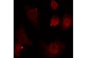 ABIN6274698 staining HeLa cells by IF/ICC. (PMS2 antibody  (C-Term))