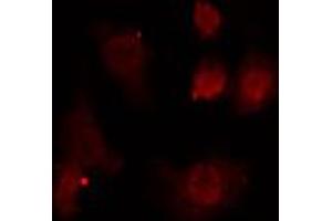 ABIN6274698 staining HeLa cells by IF/ICC.