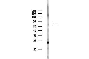 anti-Hyaluronan Binding Protein 2 (HABP2) (Internal Region) antibody