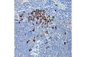 Immunohistochemistry of paraffin-embedded mouse spleen using DDIT3/CHOP Rabbit pAb (ABIN6131562, ABIN6139460, ABIN6139463 and ABIN6215170) at dilution of 1:200 (40x lens). (DDIT3 antibody  (AA 1-169))