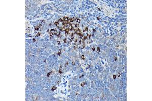 Immunohistochemistry of paraffin-embedded mouse spleen using DDIT3/CHOP Rabbit pAb (ABIN6131562, ABIN6139460, ABIN6139463 and ABIN6215170) at dilution of 1:200 (40x lens). (DDIT3 antibody  (AA 1-169))