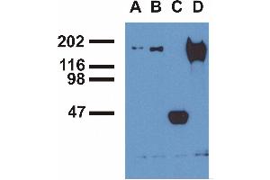 Immunoprecipitation ofEGFR from EGF-treated A431 cells byphosphospecific monoclonal antibodies (A), EM-13 (B), a commercial anti-EGFR polyclonal antibody(C) and anti-EGFR monoclonal mAb108 (D). (EGFR antibody  (Tyr992))