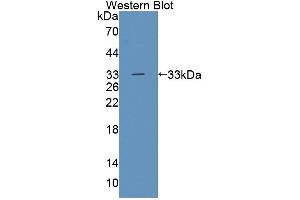 Figure. (Tec Protein Tyrosine Kinase (TEC) (AA 369-622) antibody)