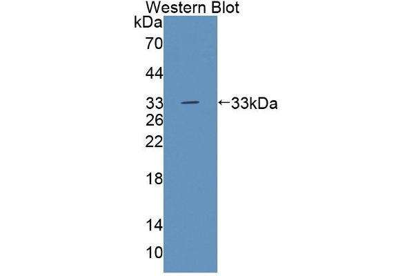 Tec Protein Tyrosine Kinase (TEC) (AA 369-622) 抗体