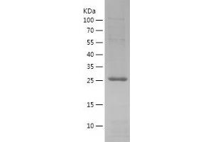 RAB9A Protein (AA 2-201) (His tag)