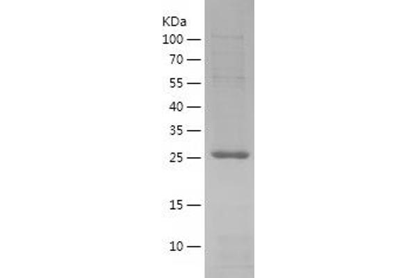 RAB9A Protein (AA 2-201) (His tag)