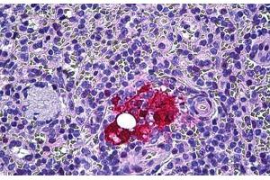 Human Spleen, Macrophages: Formalin-Fixed, Paraffin-Embedded (FFPE) (Galectin 3 antibody  (AA 141-190))