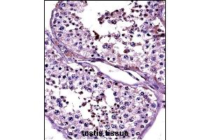 CTAG2 Antibody (Center) ((ABIN657689 and ABIN2846680))immunohistochemistry analysis in formalin fixed and paraffin embedded human testis tissue followed by peroxidase conjugation of the secondary antibody and DAB staining. (CTAG2 antibody  (AA 122-149))