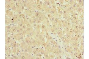 Immunohistochemistry of paraffin-embedded human liver tissue using ABIN7173011 at dilution of 1:100 (TMPRSS6 antibody  (AA 98-301))