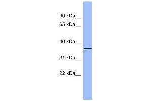 WB Suggested Anti-HAPLN1 Antibody Titration:  0. (HAPLN1 antibody  (N-Term))