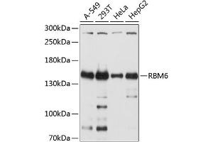 Western blot analysis of extracts of various cell lines, using RBM6 antibody (ABIN6129739, ABIN6146788, ABIN6146789 and ABIN6214632) at 1:2000 dilution. (RBM6 antibody  (AA 530-770))