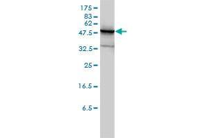 Western Blotting (WB) image for anti-phosphoglycerate Dehydrogenase (PHGDH) (AA 1-533) antibody (ABIN565240)