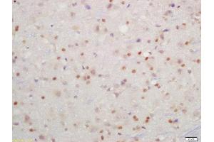 Immunohistochemistry (Paraffin-embedded Sections) (IHC (p)) image for anti-Inhibitor of kappa Light Polypeptide Gene Enhancer in B-Cells, Kinase beta (IKBKB) (pTyr199) antibody (ABIN743243)