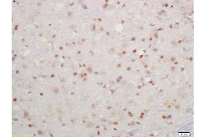 Formalin-fixed and paraffin embedded rat brain labeled with Rabbit Anti-IKK beta(Tyr199) Polyclonal Antibody, Unconjugated  at 1:200 followed by conjugation to the secondary antibody and DAB staining (IKBKB antibody  (pTyr199))