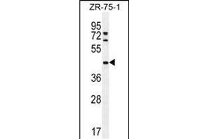 METTL2 Antibody (C-term) (ABIN655892 and ABIN2845293) western blot analysis in ZR-75-1 cell line lysates (35 μg/lane). (METTL2 antibody  (C-Term))