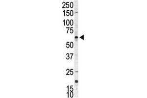 Western blot analysis of p70 S6 Kinase beta antibody and A375 cell lysate. (RPS6KB2 antibody  (AA 452-482))