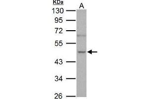 WB Image Sample (30 ug of whole cell lysate) A: PC-3 10% SDS PAGE antibody diluted at 1:1000