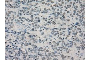 Image no. 3 for anti-Crystallin, alpha B (CRYAB) antibody (ABIN1497645) (CRYAB antibody)