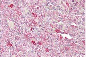 Immunohistochemistry (IHC) image for anti-Activating Transcription Factor 1 (AFT1) (C-Term) antibody (ABIN2780654)