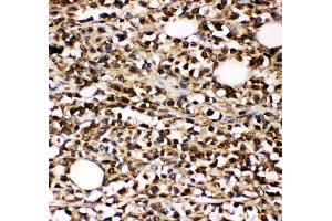 Anti-CD10 Picoband antibody,  IHC(P): Human B lymphocyte Cancer Tissue (MME antibody  (AA 52-750))