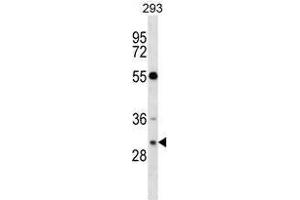 RASD2 Antibody (Center) western blot analysis in 293 cell line lysates (35ug/lane). (RASD2 antibody  (Middle Region))