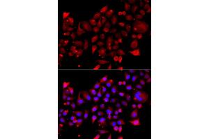 Immunofluorescence analysis of A549 cell using RRM2B antibody. (RRM2B antibody)