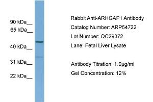 WB Suggested Anti-ARHGAP1  Antibody Titration: 0. (ARHGAP1 antibody  (N-Term))