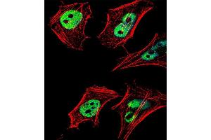 Fluorescent confocal image of Hela cell stained with HDAC2 Antibody (C-term) (ABIN6242378 and ABIN6577318).