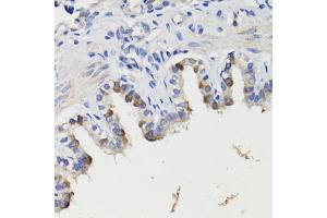 Immunohistochemistry of paraffin-embedded rat bronchus using DEPDC6 antibody (ABIN7266738) at dilution of 1:200 (40x lens). (DEPTOR antibody  (AA 1-220))