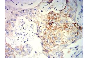 Immunohistochemical analysis of paraffin-embedded brain tissues using GZMB mouse mAb with DAB staining. (GZMB antibody  (AA 21-247))