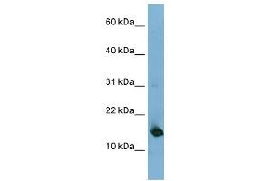 MED31 antibody used at 1 ug/ml to detect target protein. (MED31 antibody  (N-Term))