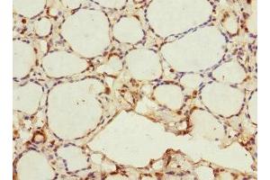 Immunohistochemistry of paraffin-embedded human thyroid tissue using ABIN7165806 at dilution of 1:100 (MEMO1 antibody  (AA 1-297))