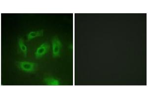 Immunofluorescence analysis of HeLa cells, using TGF beta Receptor I (epitope around residue 165) antibody. (TGFBR1 antibody  (Ser165))