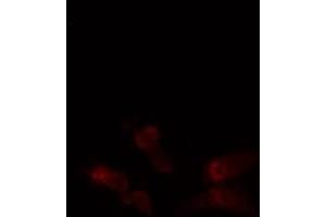 ABIN6276354 staining  Hela cells by IF/ICC. (ABL1 antibody  (N-Term))