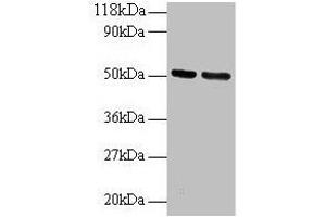 Western blot All lanes: GDI2 antibody at 2 μg/mL Lane 1: 293T whole cell lysate Lane 2: EC109 whole cell lysate Secondary Goat polyclonal to rabbit IgG at 1/15000 dilution Predicted band size: 51, 46 kDa Observed band size: 51 kDa (GDI2 antibody  (AA 1-441))