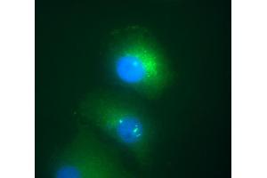 Immunofluorescence staining of Daxx in transfected HeLa human cervix carcinoma cell line. (DAXX antibody  (AA 558-740))