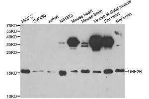 Western blot analysis of extracts of various cell lines, using UBE2B antibody. (UBE2B antibody  (AA 1-152))