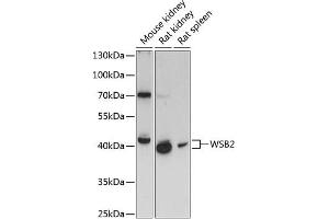 Western blot analysis of extracts of various cell lines, using WSB2 antibody (ABIN6133280, ABIN6150269, ABIN6150270 and ABIN6216800) at 1:3000 dilution. (WSB2 antibody  (AA 1-200))