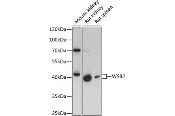 WSB2 Antikörper  (AA 1-200)