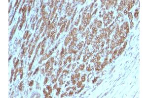 Formalin-fixed, paraffin-embedded human Tonsil stained with Catenin beta Mouse Monoclonal Antibody (CTNNB1/2098). (CTNNB1 antibody)