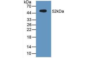 Western blot analysis of recombinant Mouse MUC1. (MUC1 antibody  (AA 474-630))