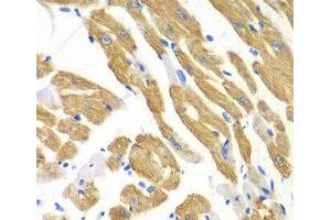 Immunohistochemistry of paraffin-embedded Mouse heart using AIMP1 Polyclonal Antibody at dilution of 1:100 (40x lens). (AIMP1 antibody)